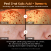 02 Peel Shot Kojik Acid Turmeric Serum.png