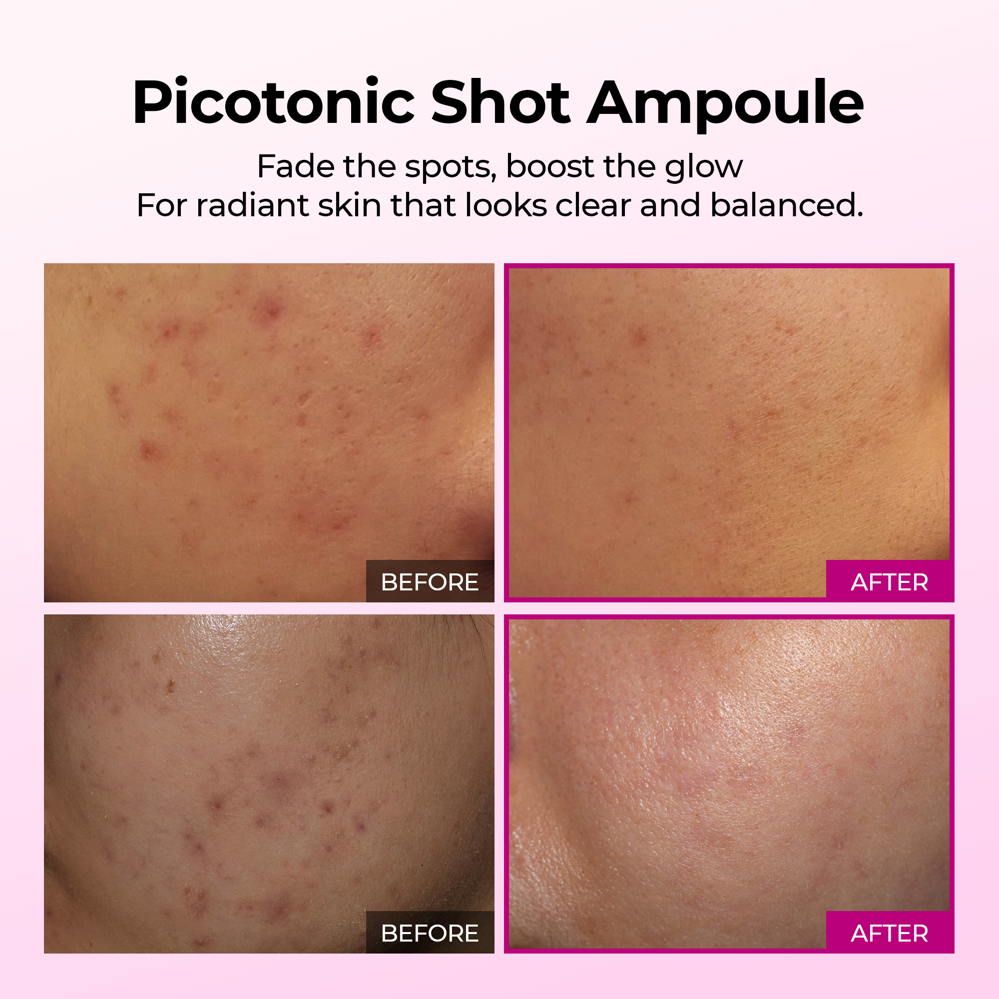 250704 PICOTONIC AMPOULE 2.png